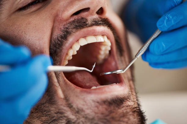 Best Emergency Cosmetic Dentistry in Great Bend, NY